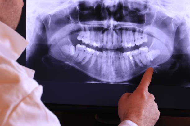 Best Emergency Tooth Extraction in Moosup, CT
