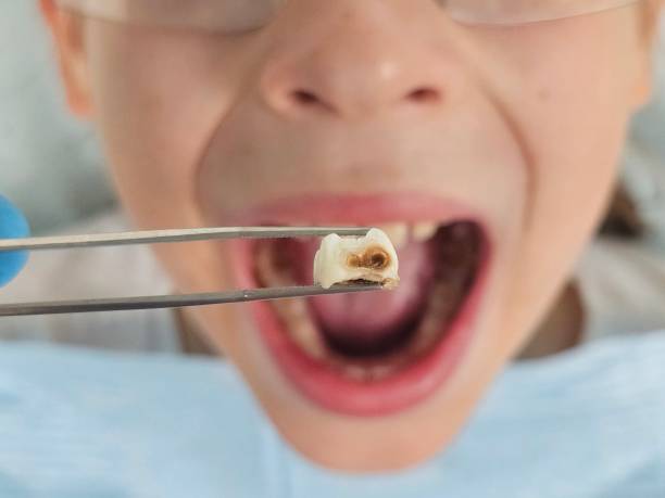 Best After-Hours Emergency Dentist in Moosup, CT
