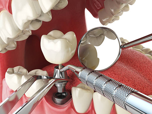 Best After-Hours Emergency Dentist in Moosup, CT